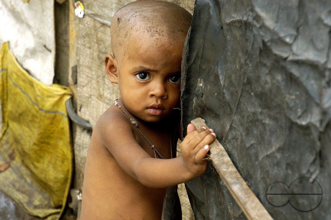 Food crisis ravages India?s poorest children.