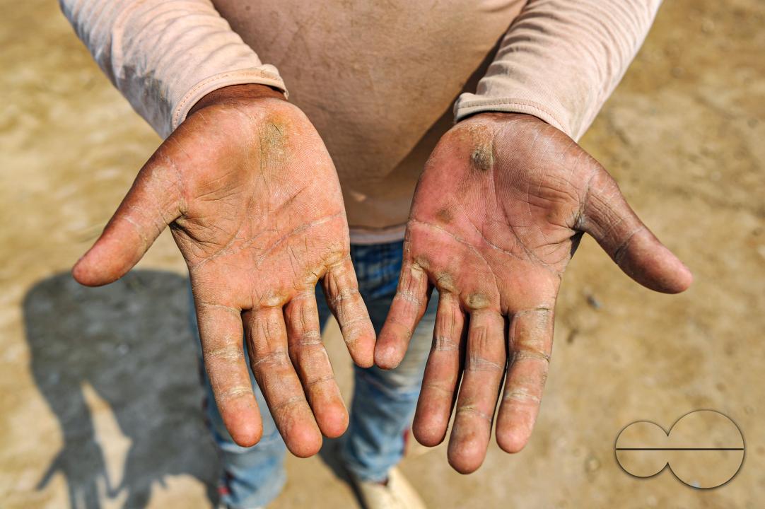 Male and female workers are breaking LC stones with a crusher machine in Bholaganj area, known as the 'Stone State' of Sylhet Companyganj Upazila
