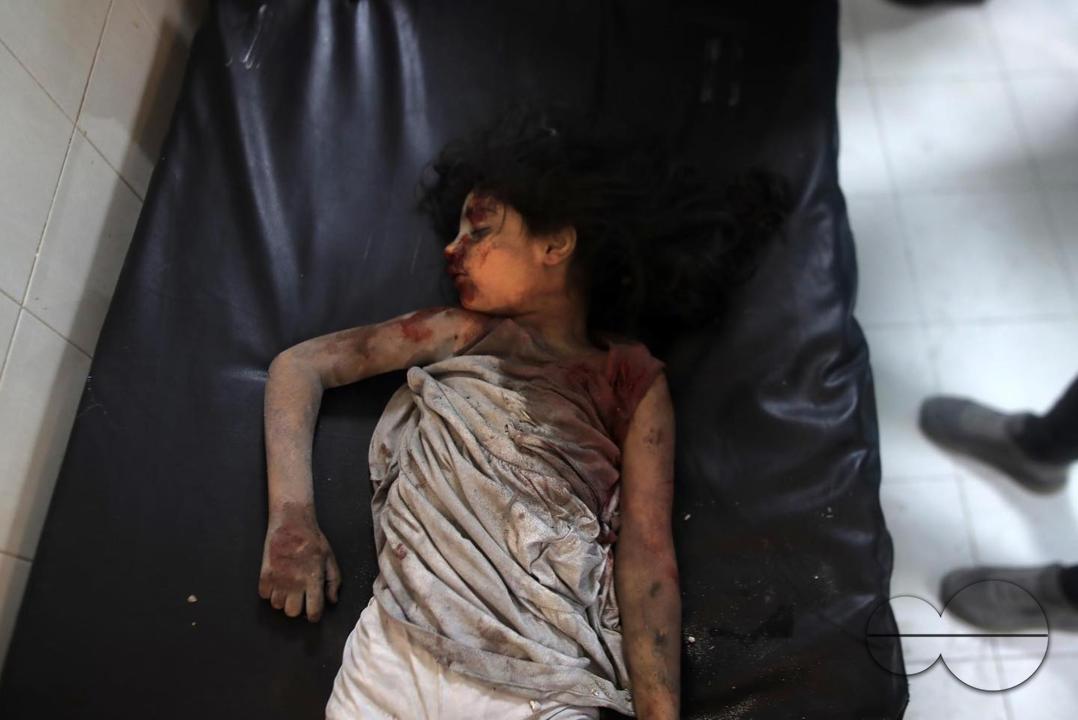 The body of an innocent child at the hospital