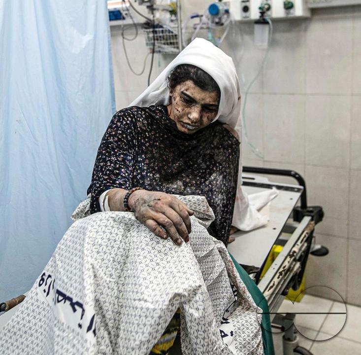 An injured Palestinian woman in Nasser Hospital after her family home was bombed in Khan Yunis, south of the Gaza Strip