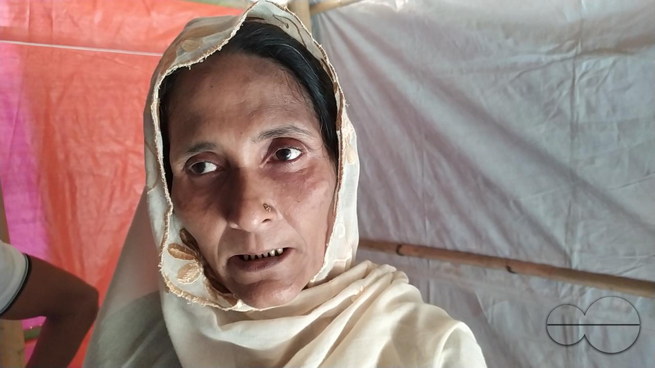 Portrait of a woman in dismay at the Balukhali refugee camp