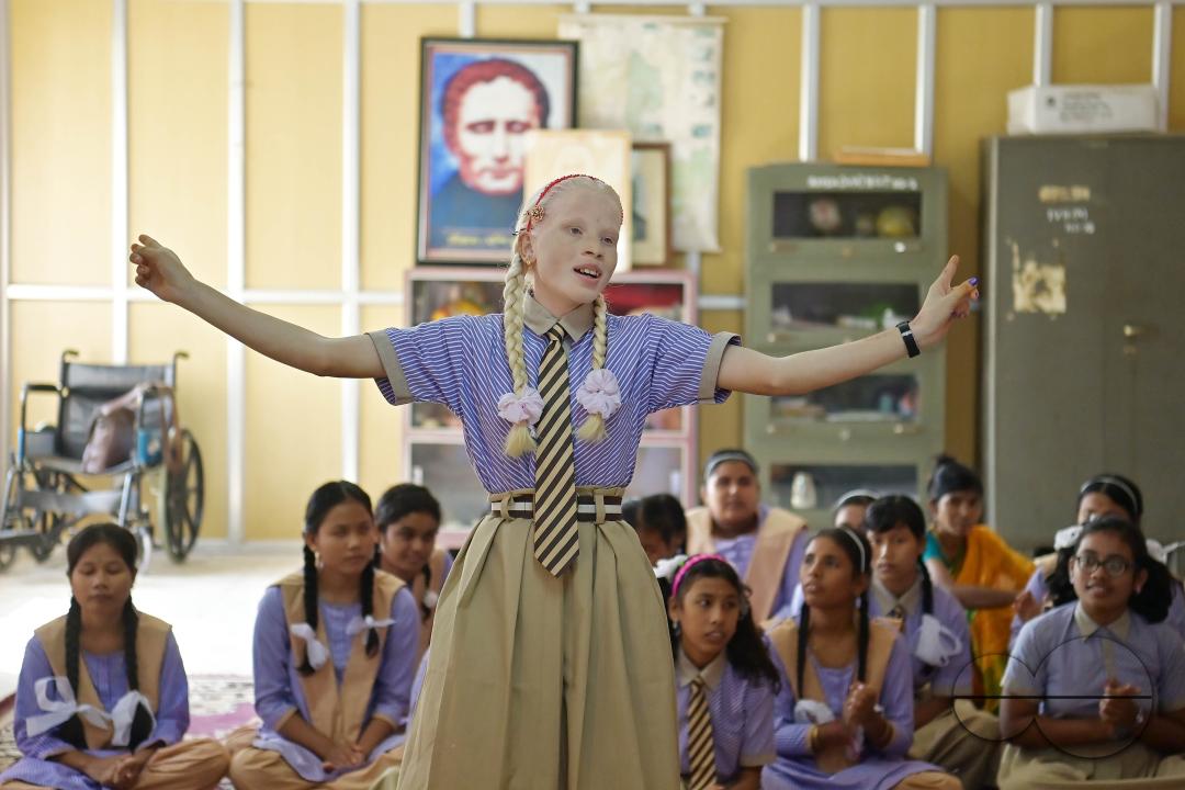 A student at the Institute for Visually Handicapped is performing a dance during the 'Children's Day' celebration at the institute's campus in Narsingarh, in Agartala