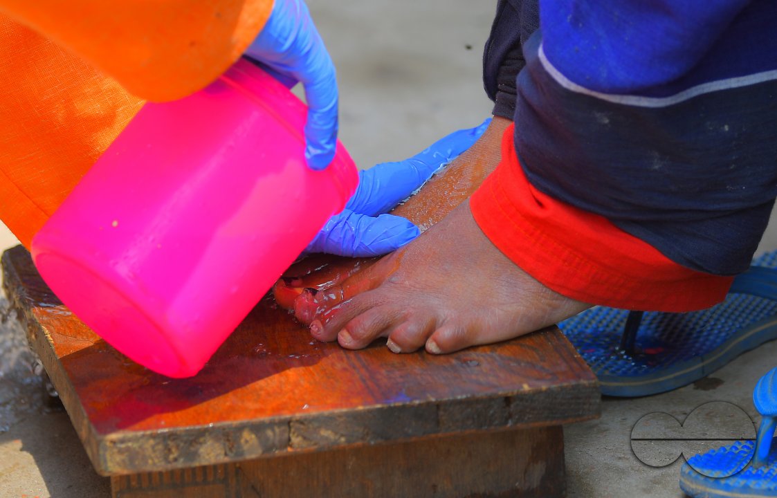 Cleaning the feet of safari workers (Cleaning Staff)