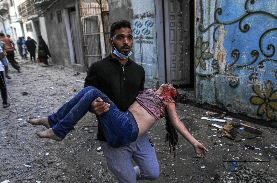 A Palestinian father carries his blood-soaked daughter after his house was targeted in the Al-Zaytoun neighborhood, east of Gaza City