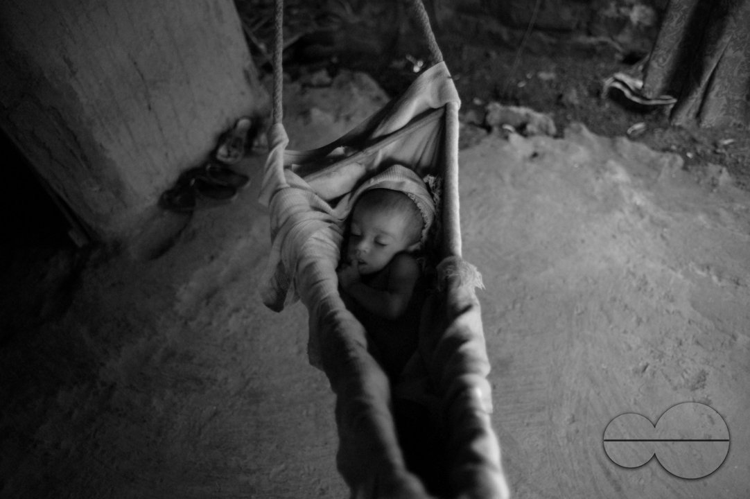 Malnutrition in Mumbai