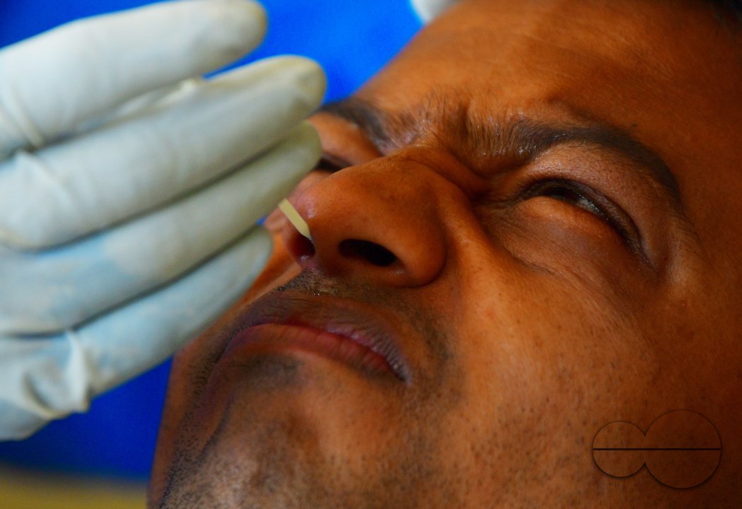 Journalists, going through under swab test